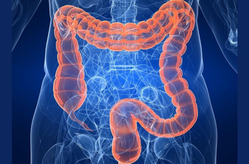  Conoce los síntomas del cáncer de Colon: Así puedes detectar el quinto tumor más diagnosticado del Perú.