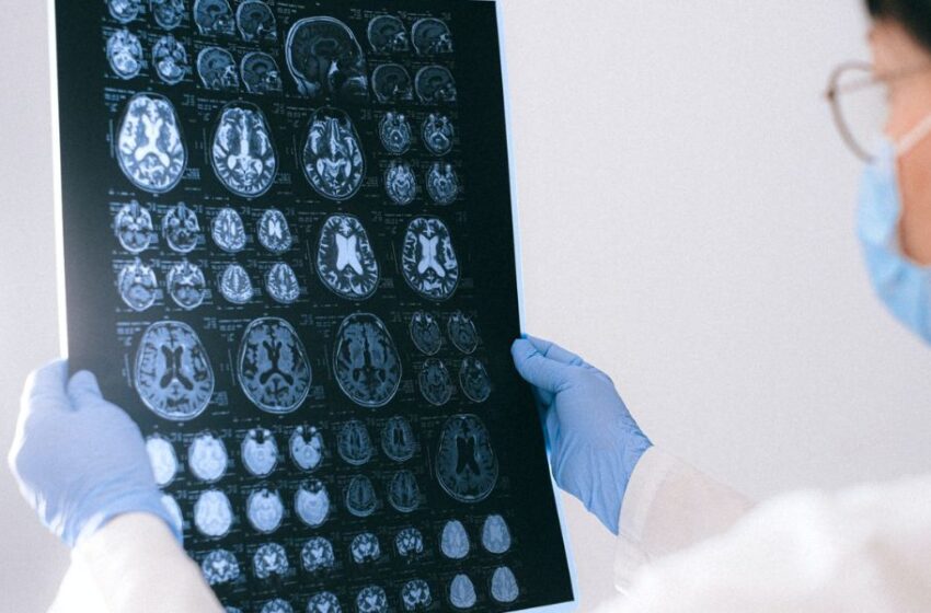  Sigue estos 3 consejos para mejorar la función cerebral