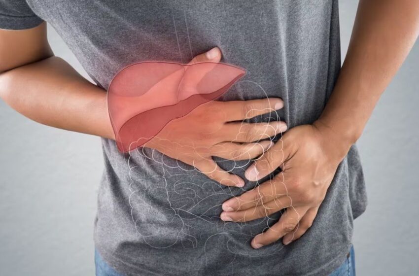  Cáncer de hígado: Perú registra más de 2,174 casos anuales de carcinoma hepatocelular