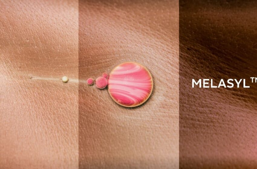  L’Oréal presenta Melasyl: el hallazgo de una molécula innovadora para tratarlas manchas en la piel.