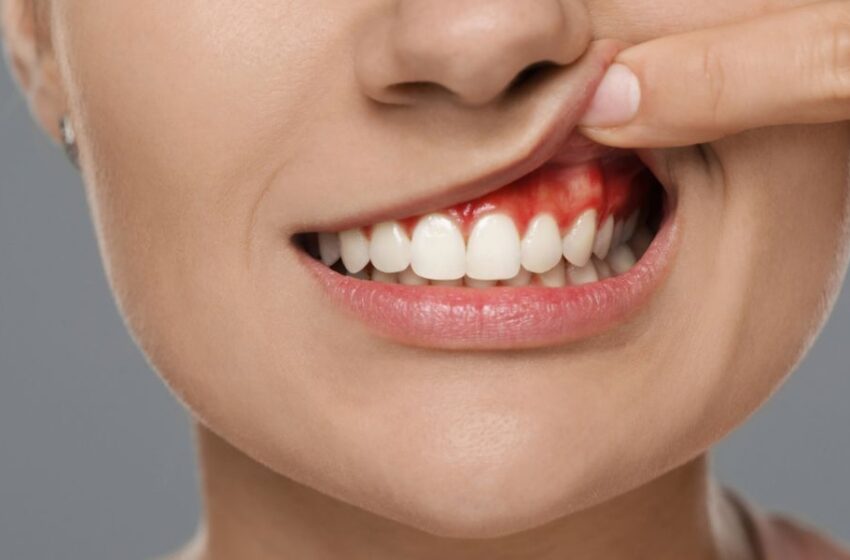  ¡Cuidado! Las enfermedades de las encías pueden provocar pérdida de los dientes