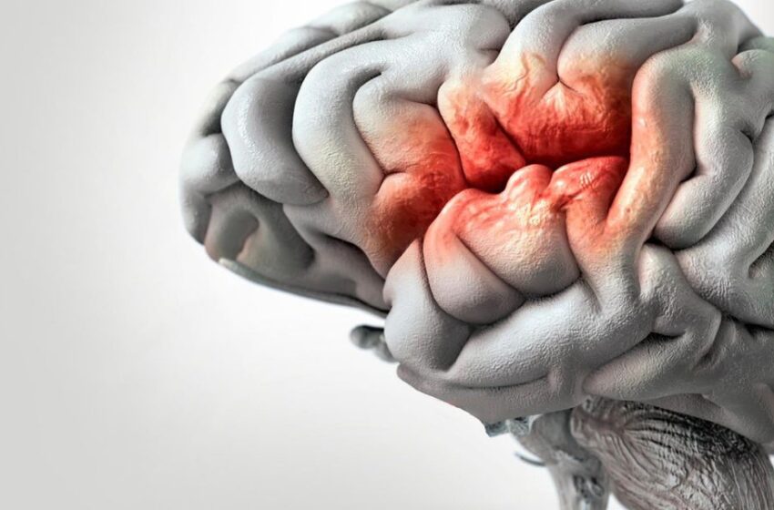  Cada minuto cuenta: Cómo prevenir un accidente cerebrovascular en personas con Diabetes Tipo 2