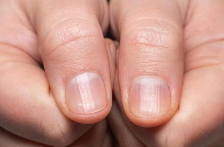  Descubre qué dicen tus uñas sobre tu salud